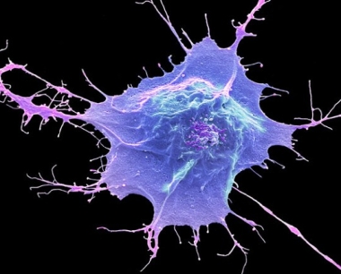日本开创性的干细胞试验报告了有希望的早期结果