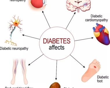 糖尿病并发症有哪些？