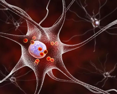人神经细胞移植对帕金森病的4年有效性、安全性随访研究