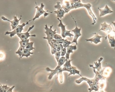 什么是胚胎干细胞？