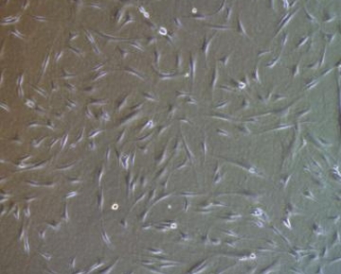 神秘的间充质干细胞能做什么？