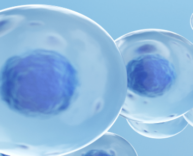 间充质干细胞在治疗特发性帕金森病中的安全性如何？