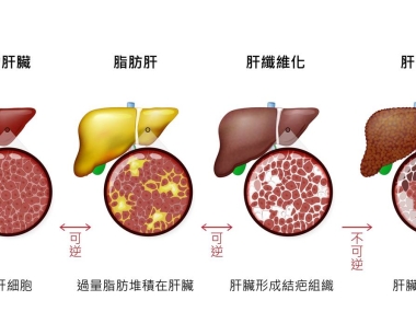 王福生院士6年研究证实，干细胞治疗可提高肝硬化患者长期生存率