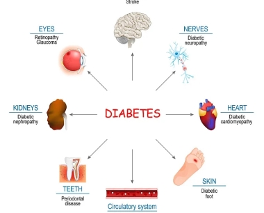糖尿病如何影响身体？