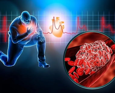 间充质干细胞治疗心血管疾病的临床研究进展