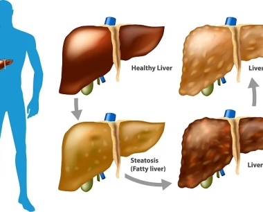 六大类肝脏疾病的症状及迹象
