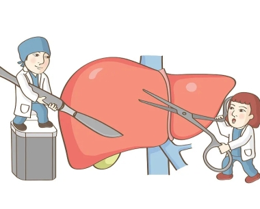 关于肝移植的事实