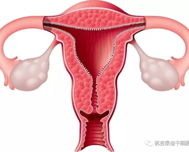 脐带间充质干细胞治疗卵巢早衰不孕症的临床应用