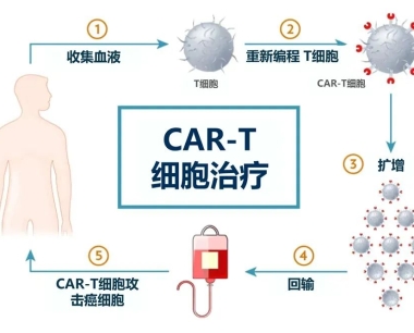 CAR-T细胞疗法介绍