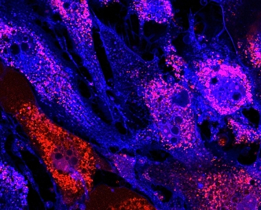 间充质干细胞治疗的未来走向如何？