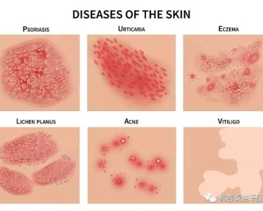 间充质干细胞治疗炎症性皮肤病的临床潜力和作用方式是什么？