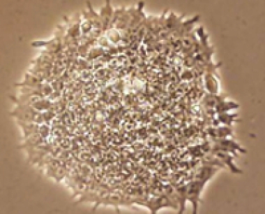 我们还需要研究人类胚胎干细胞吗？