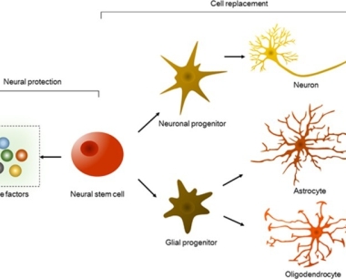 神经干细胞移植治疗神经系统疾病的应用进展