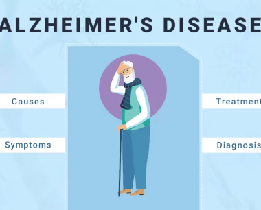 阿尔茨海默病：原因、症状、诊断、治疗