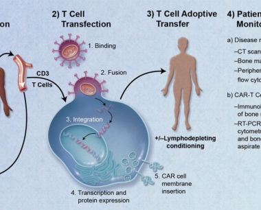 什么是CAR-T细胞疗法？治疗癌症的新方法
