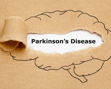 干细胞治疗帕金森病的方法及修复帕金森病患者多巴胺神经元的机制