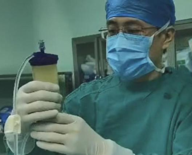 青岛市中心医院：创新脂肪干细胞疗法，为60岁患者解除十年关节炎困扰
