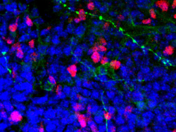 干细胞移植可能是治疗精神分裂症的新方法