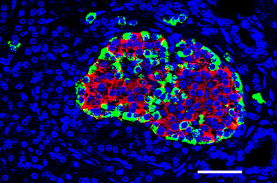成人胰岛的免疫组织化学。 红色显示胰岛素染色，绿色显示胰高血糖素，蓝色显示细胞核。