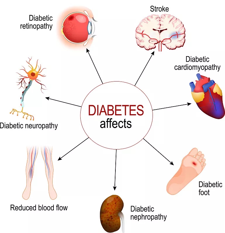 糖尿病影响糖尿病的并发症