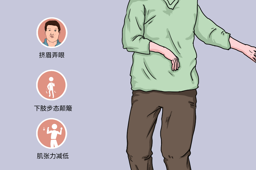 干细胞疗法治疗亨廷顿病的临床前试验进展