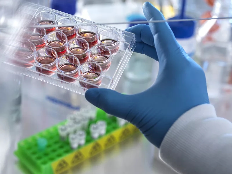 间充质干细胞治疗阿尔茨海默病的临床前研究 间充质干细胞治疗阿尔茨海默病的临床前研究