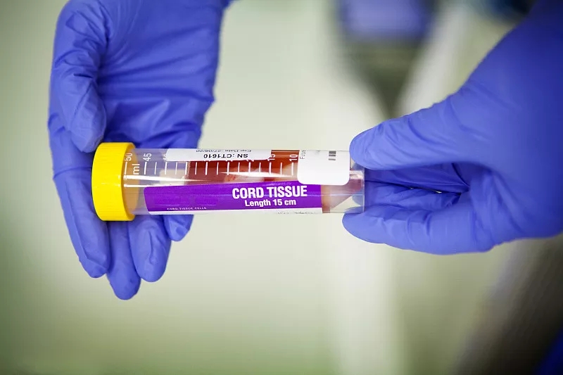 间充质干细胞的优点有哪些? 间充质干细胞的优点有哪些?