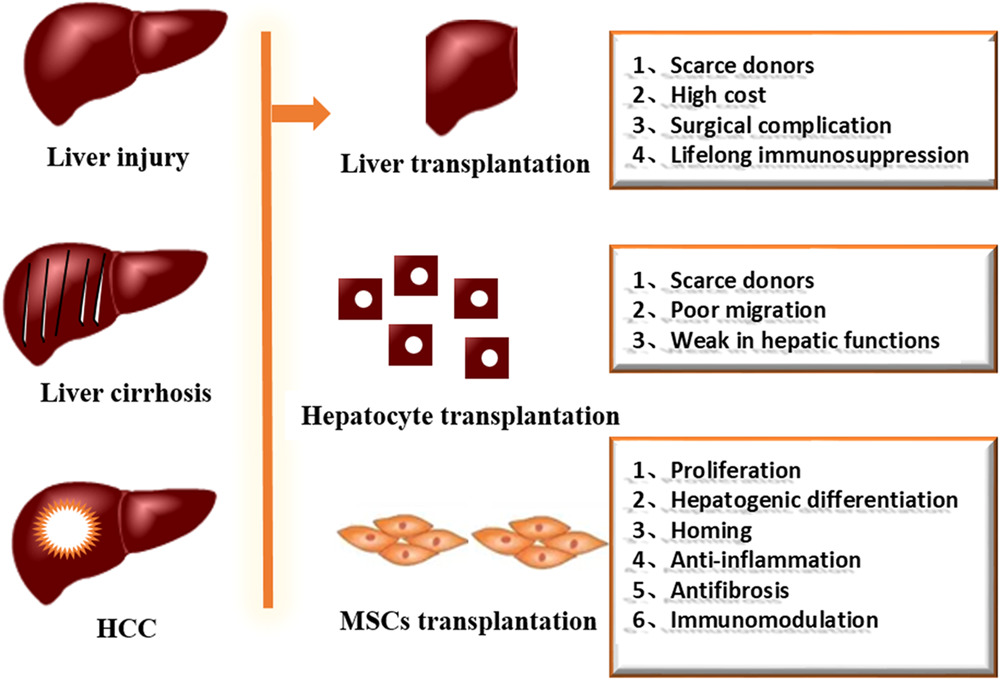 间充质干细胞治疗肝损伤的临床研究进展
