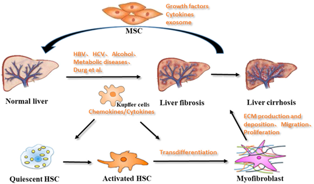 肝纤维化的形成机制