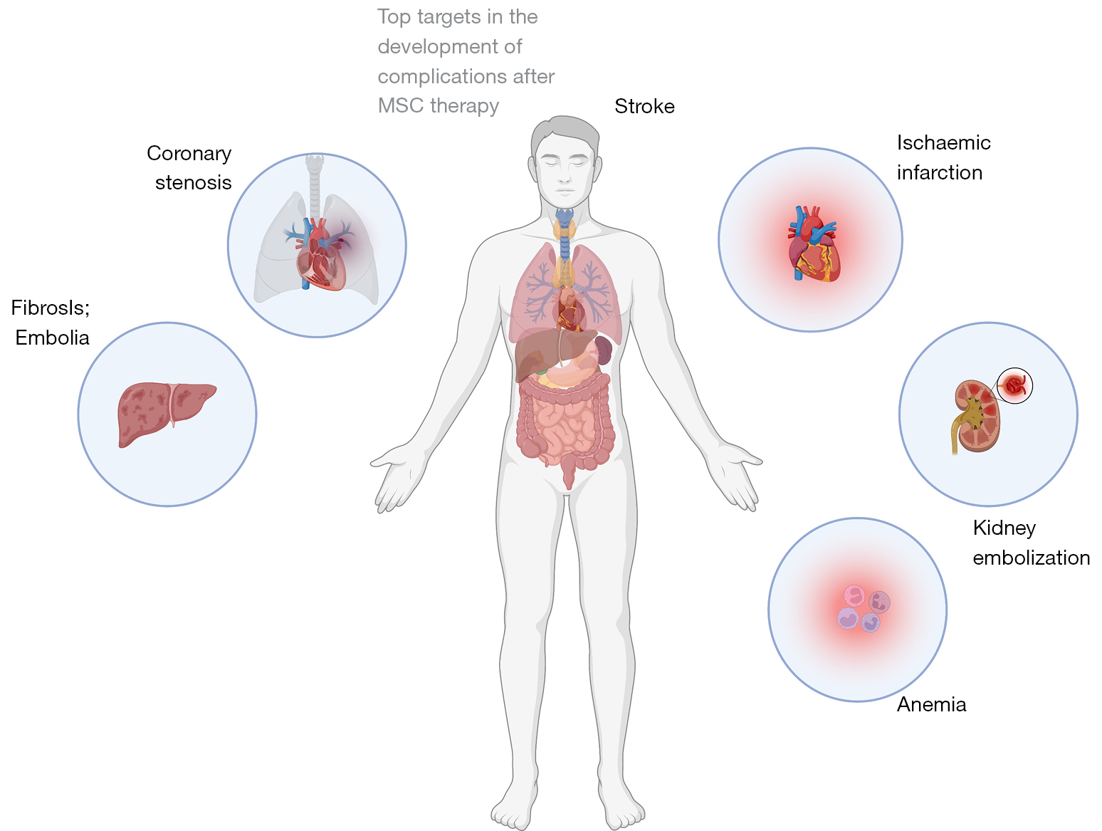 图2：间充质干细胞治疗的不良事件和副作用引起的并发症。