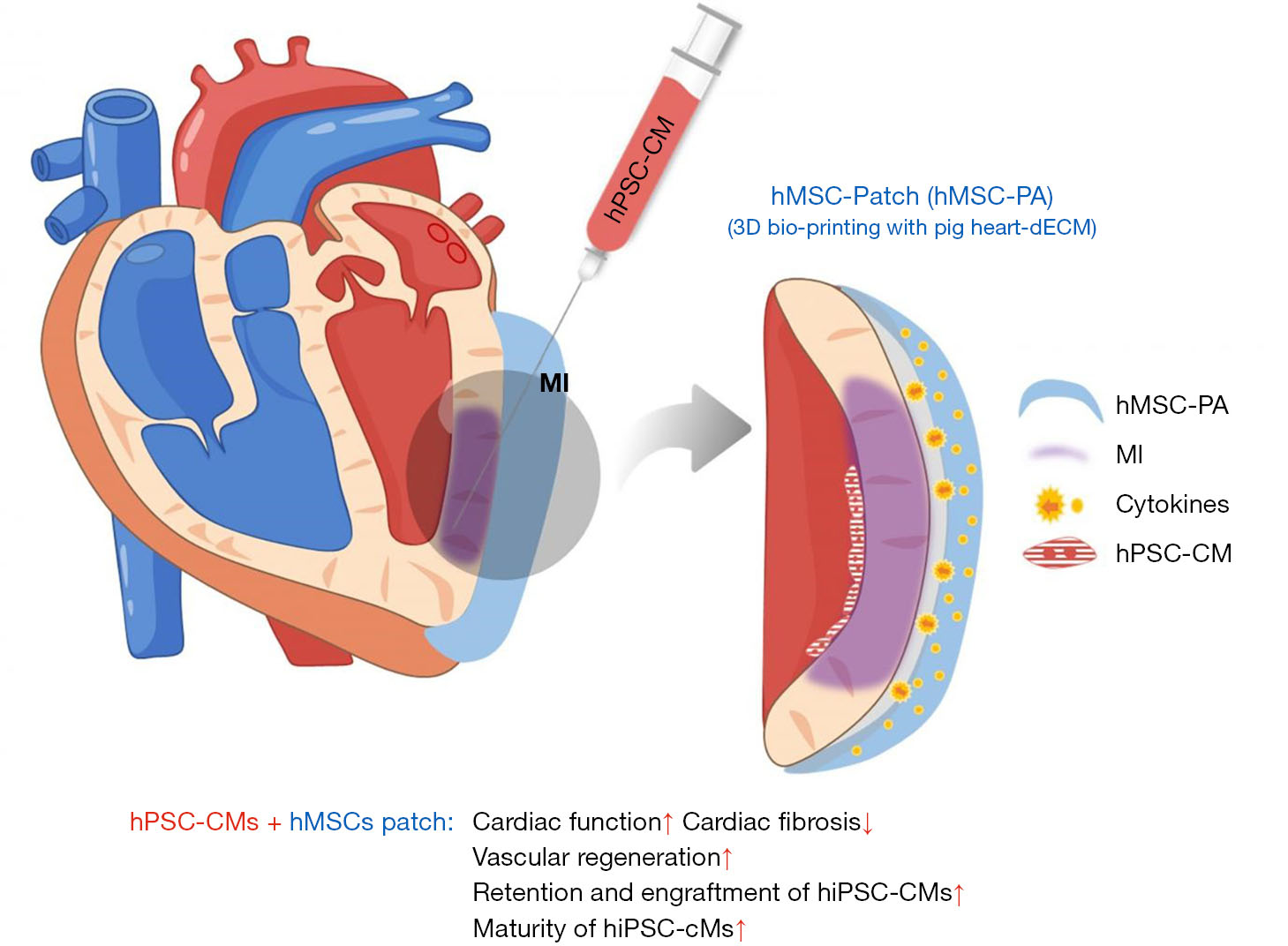 干细胞治疗心血管疾病