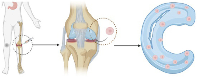 图1：干细胞注射方法的过程示意图。