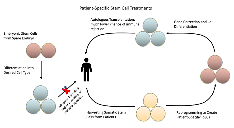 图2：可以从患者体内采集成体干细胞并将其重新编程为诱导多能干细胞，以创建针对患者的疗法，从而降低免疫排斥的风险