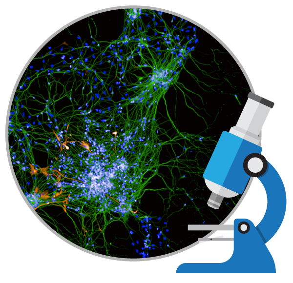 干细胞能治疗好阿尔茨海默症吗?