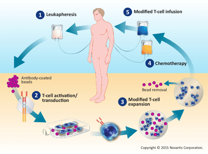 CAR-T细胞疗法流程图