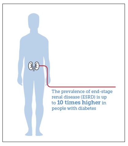 糖尿病并发症肾病