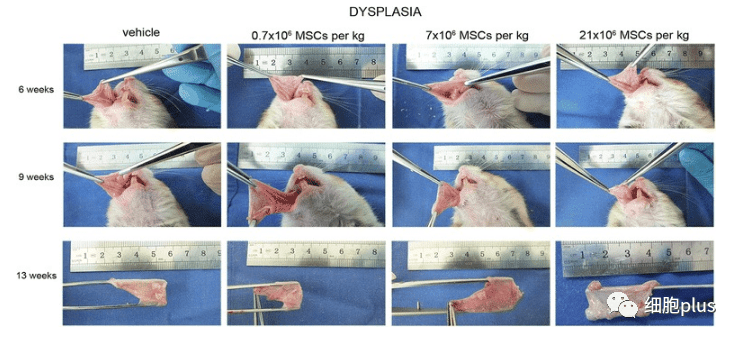 在肿瘤增生期，全身注射同种异体间充质干细胞不会加速癌前病变的进展。