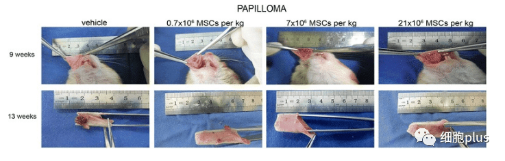 在非典型增生期，全身注射同种异体间充质干细胞不会加速癌前病变的进展。
