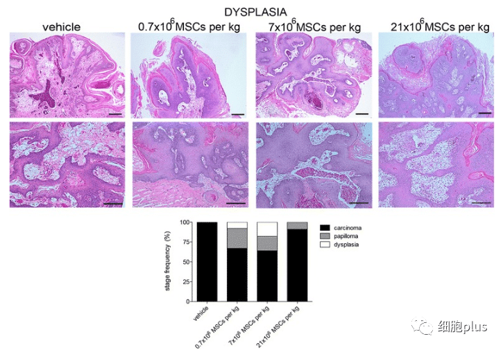 在增生期，全身注射同种异体间充质干细胞不会增加肿瘤的恶性程度。