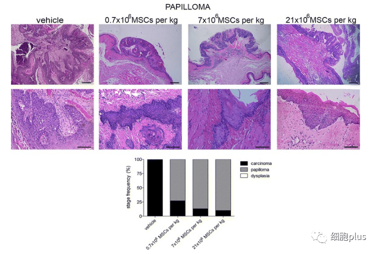 在非典型增生期，全身注射同种异体间充质干细胞不会增加肿瘤的恶性程度。