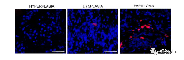 4 全身注射同种异体间充质干细胞很少进入癌前病变