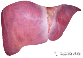 干细胞如何治疗慢性肝病? 干细胞如何治疗慢性肝病?