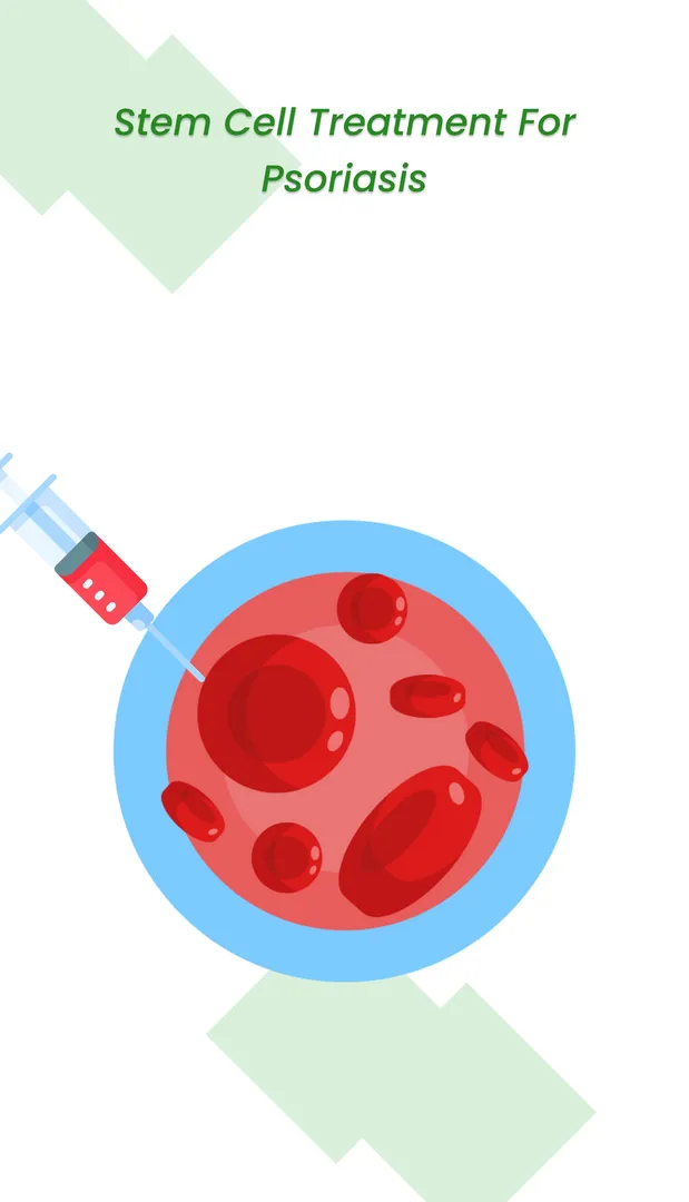 干细胞治疗牛皮癣