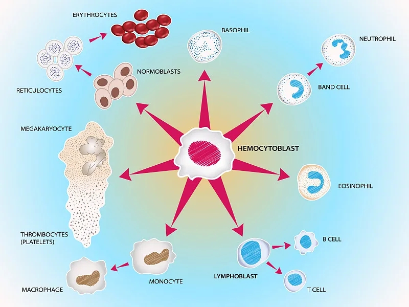 造血干细胞移植治疗系统性红斑狼疮