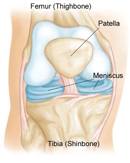 正常的膝盖解剖结构。半月板是两个橡胶状的圆盘，有助于缓冲膝关节