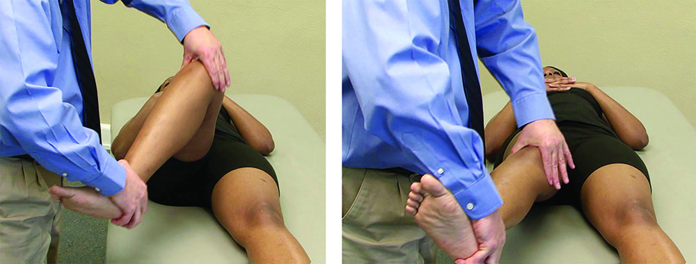 McMurray 测试(此处显示)将帮助您的医生确定您是否患有半月板撕裂