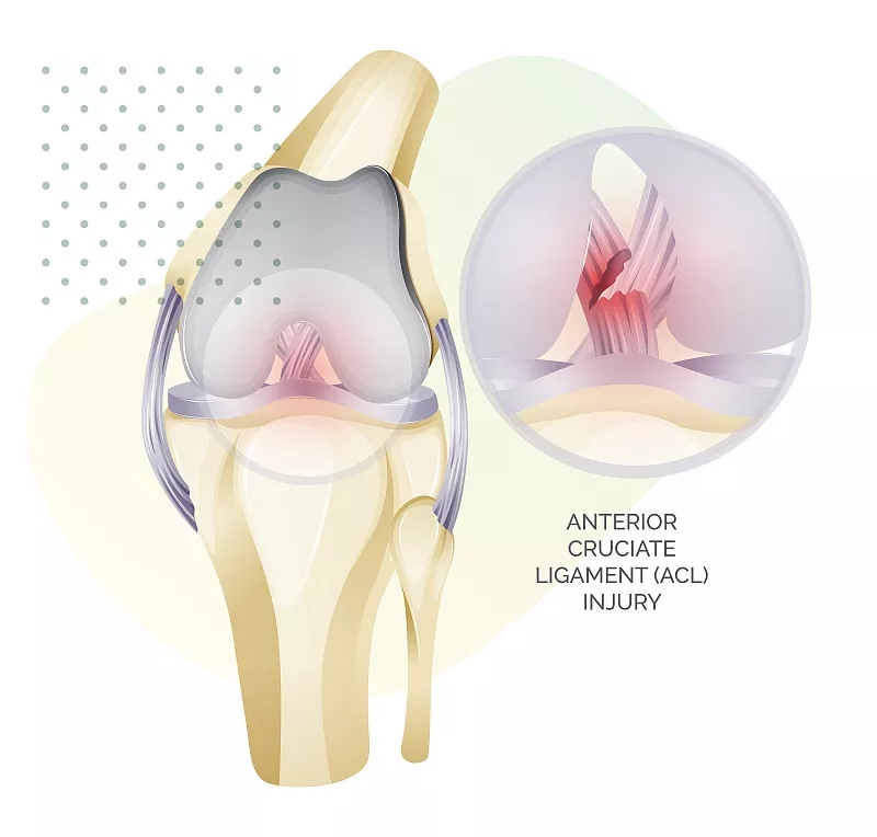 干细胞疗法对半月板损伤的益处