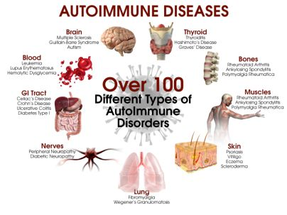 10 种常见自身免疫性疾病