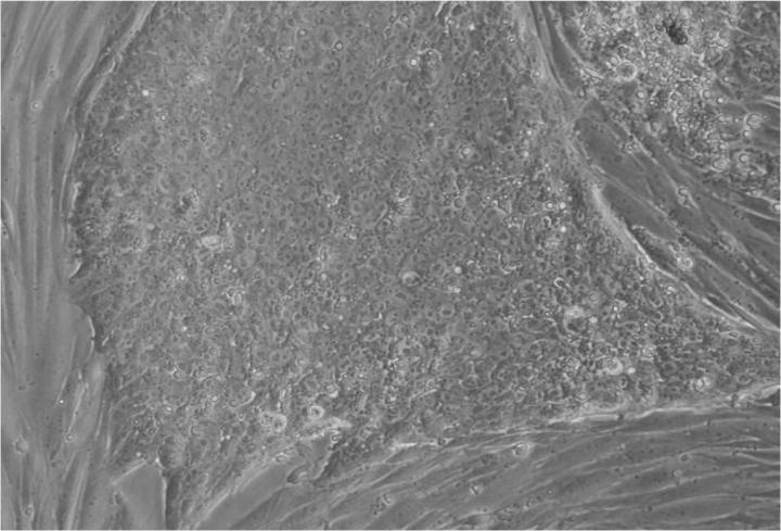 胚胎干细胞移植的来源