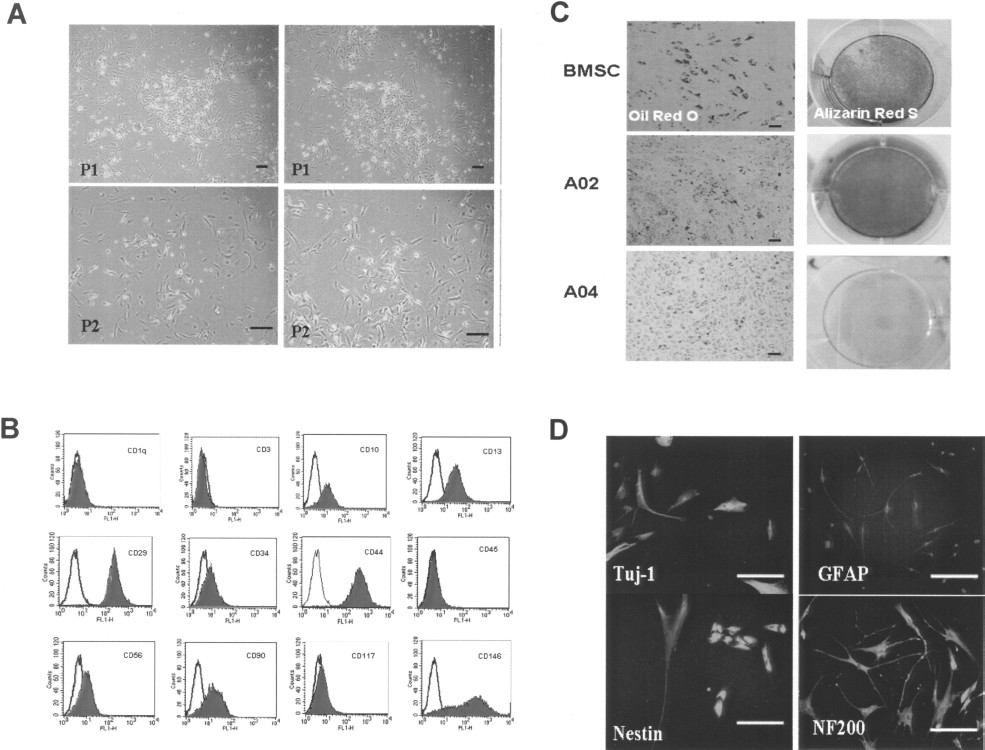 图2：源自人子宫内膜息肉 (EPMSC) 的MSC
